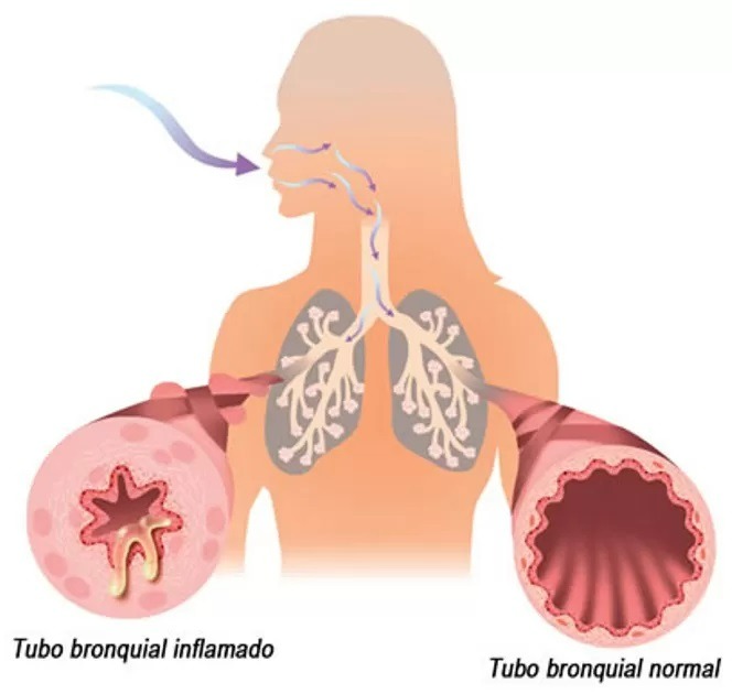 Imagen del Artículo