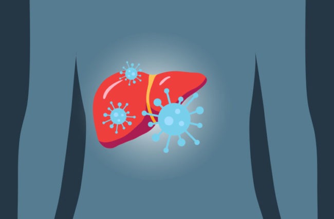 La Hepatitis C. La importancia de un diagnóstico temprano