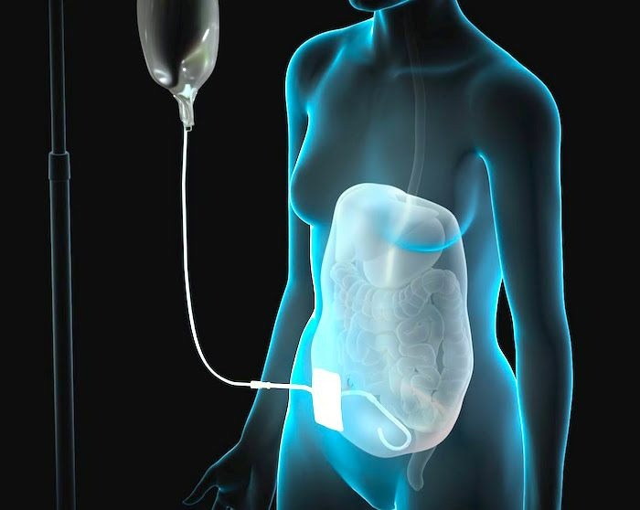 LAS TERAPIAS QUE DAN ESPERANZA DE VIDA AL ENFERMO RENAL