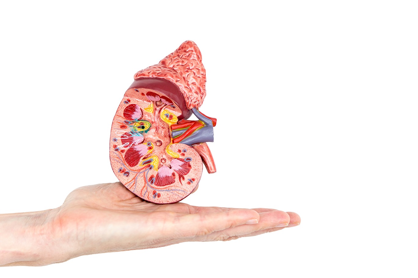 Más del 85% de los pacientes de Enfermedad Renal Crónica se encuentran sin diagnosticar